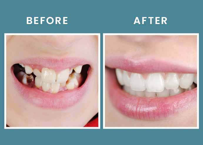 dental before after
